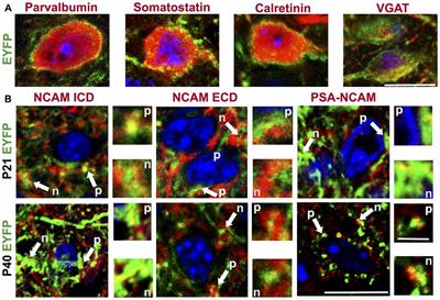 NCAM Regulates Inhibition and Excitability in Layer 2/3 Pyramidal Cells of Anterior Cingulate Cortex